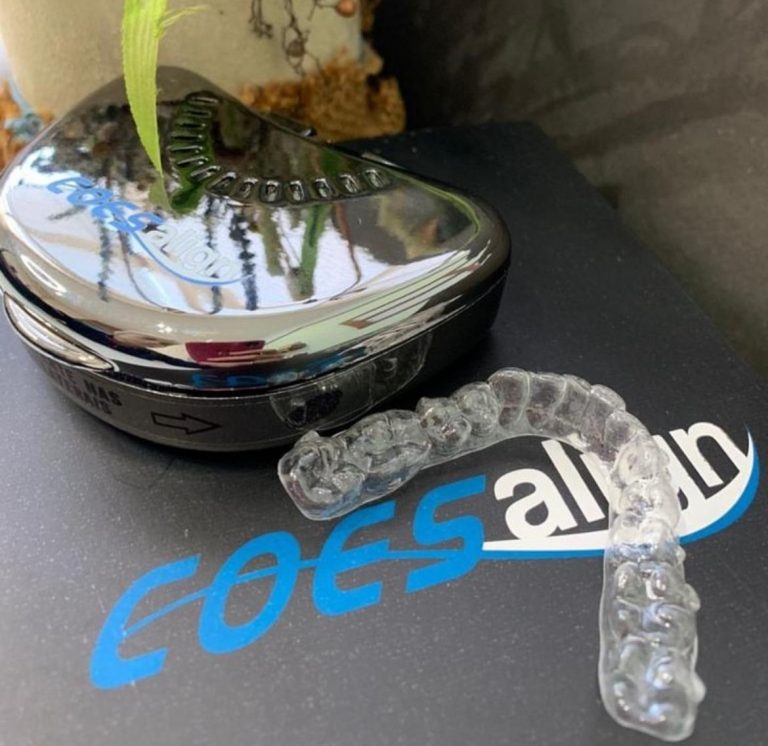 COES ALIGN - Alinhadores In Office, produzidos diretamente no consultório